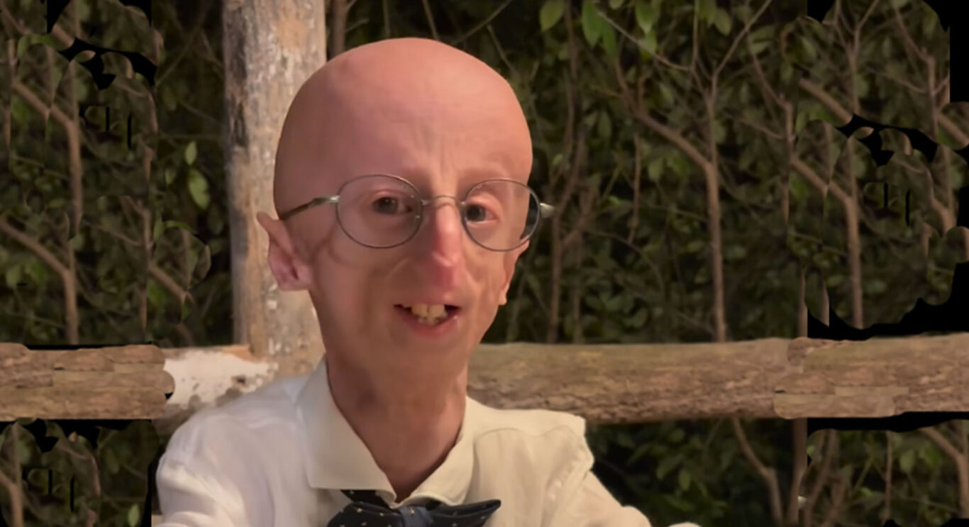 Morto Sammy Basso, il biologo affetto da progeria